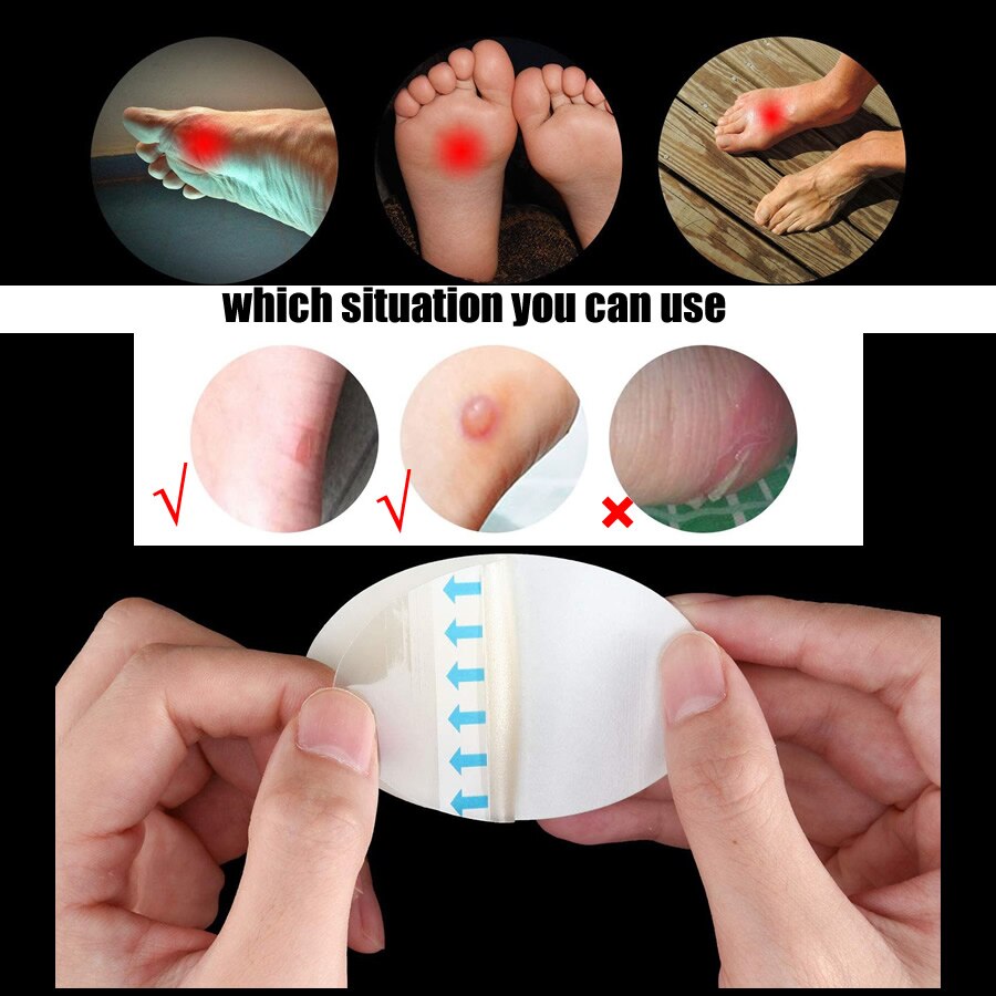 5pcs-Hydrocolloid-Dressing-Heel-Tape-Anti-Wear-Band-Aid-Adhesive-Bandage-First-Aid-kit-Home-Travel-3